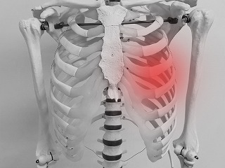 交通事故による骨折・打撲・捻挫